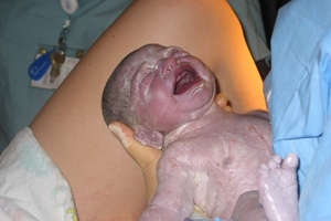 Hospitals get cash to invest in maternity safety equipment