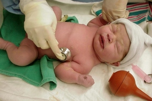 IBM working with University College Cork to improve long-term outcomes for babies in neonatal intensive care

