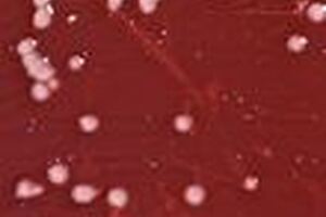 IDEXX Pseudalert receives UK acceptance for Pseudomonas testing in drinking water