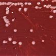 IDEXX Pseudalert receives UK acceptance for Pseudomonas testing in drinking water