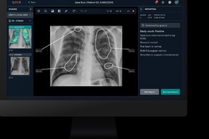 InHealth partners with Qure.ai to enhance telereporting services