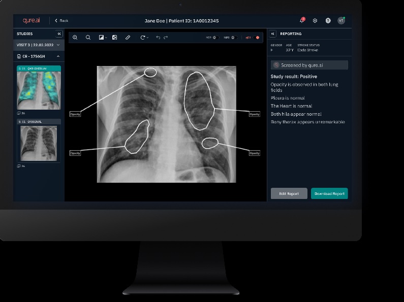 InHealth partners with Qure.ai to enhance telereporting services