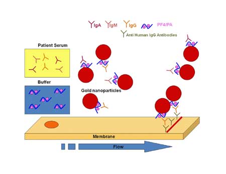 Innovative assay excludes HIT in 10 minutes