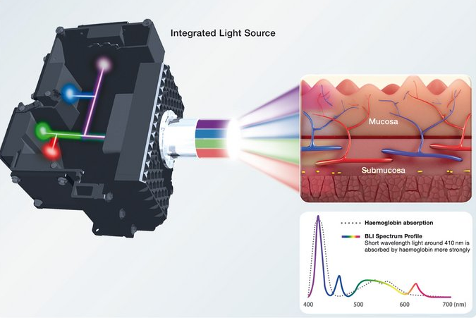 Innovative ELUXEO endoscopes provide dramatically-improved illumination 