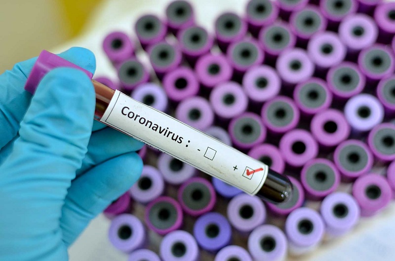 InterSystems releases Novel Coronavirus screening functionality for TrakCare