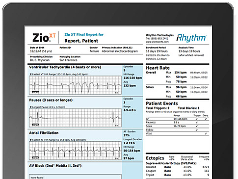 iRhythm Technologies announces NHS funding for cardiac monitoring device
