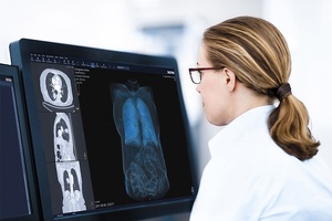 Kent NHS modernises patient diagnostics with Sectra