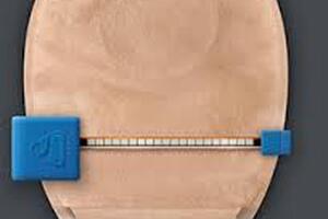 Launch of new device to transform lives of bowel disease patients