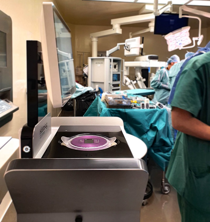 Leeds neurosurgeons trial ultrafast scanner to accelerate treatment of brain tumours