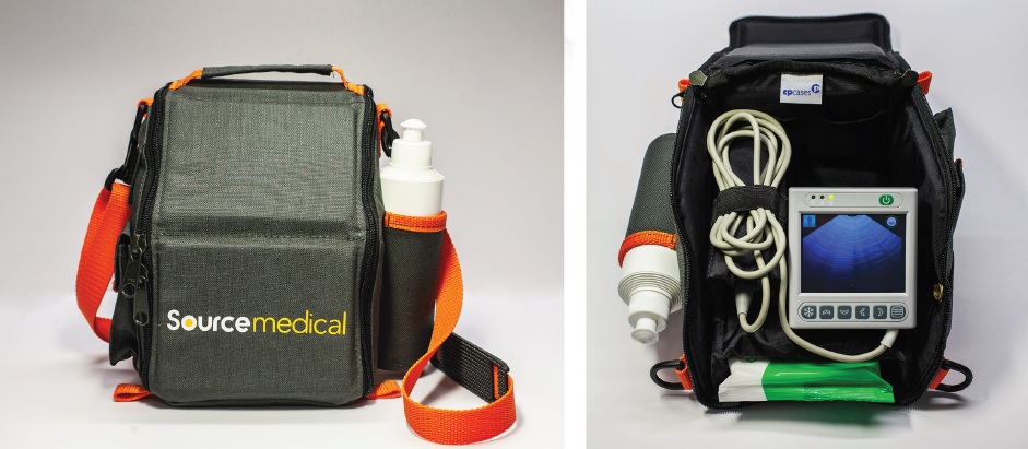 Lightweight compact casing solution for innovative 3D bladder scanning technology