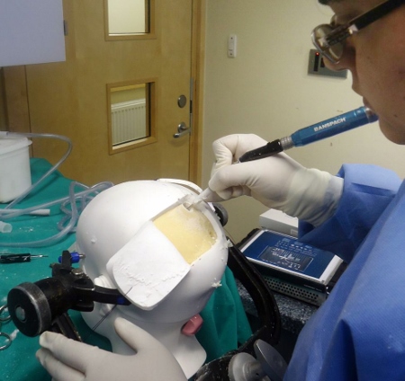Neurological stimulator nominated for national innovation award
