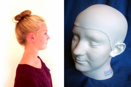 Neurosurgeon uses daughter’s head to create surgery simulator 