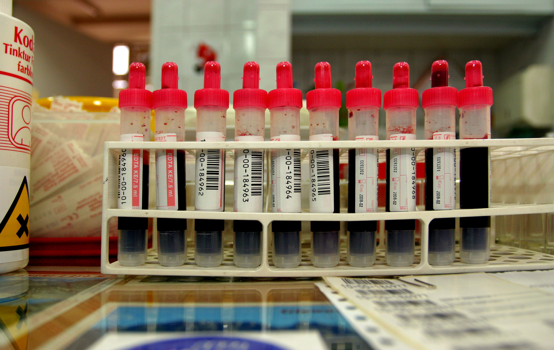 New blood test to detect liver damage in under an hour