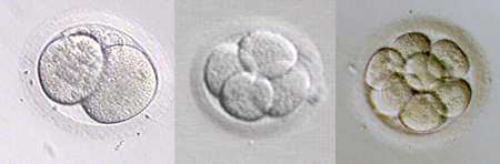New IVF technology captures embryos on video