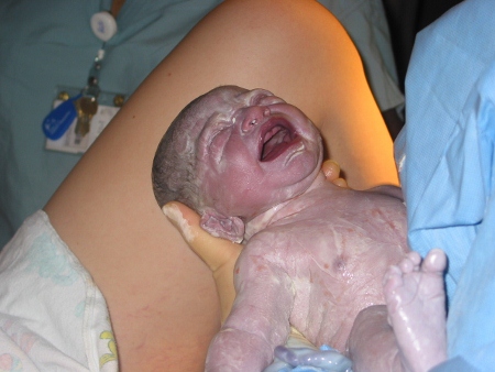 New screening test for Down\'s Syndrome could prevent miscarriage