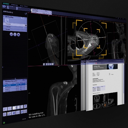 New version of syngo.via brings anatomical intelligence to diagnostic reading