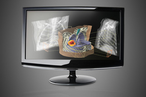 NHS Supply Chain agrees national deal to deliver cancer treatment systems