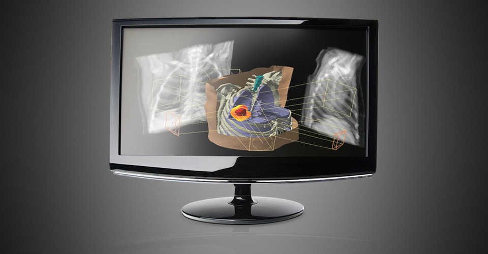 NHS Supply Chain agrees national deal to deliver cancer treatment systems