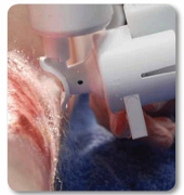NICE launches first clinical trial into medical device effectiveness