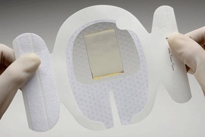NICE plans to recommend a technology to hold catheters in place and reduce infection risk