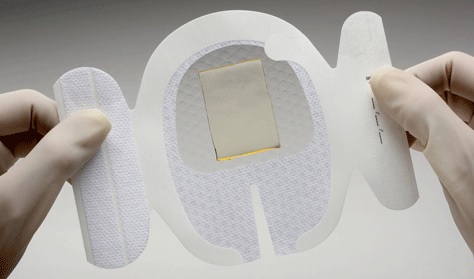 NICE plans to recommend a technology to hold catheters in place and reduce infection risk