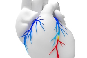 NICE throws weight behind non-invasive cardiac diagnostics technology
