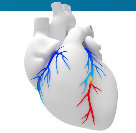NICE throws weight behind non-invasive cardiac diagnostics technology