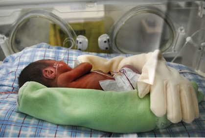 Novel Zaky Hands used to improve lives of premature babies