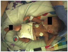 Oxehealth advances baby safety with camera-based vital signs monitoring 