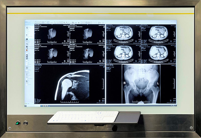 PACS Console receives positive response from hospitals