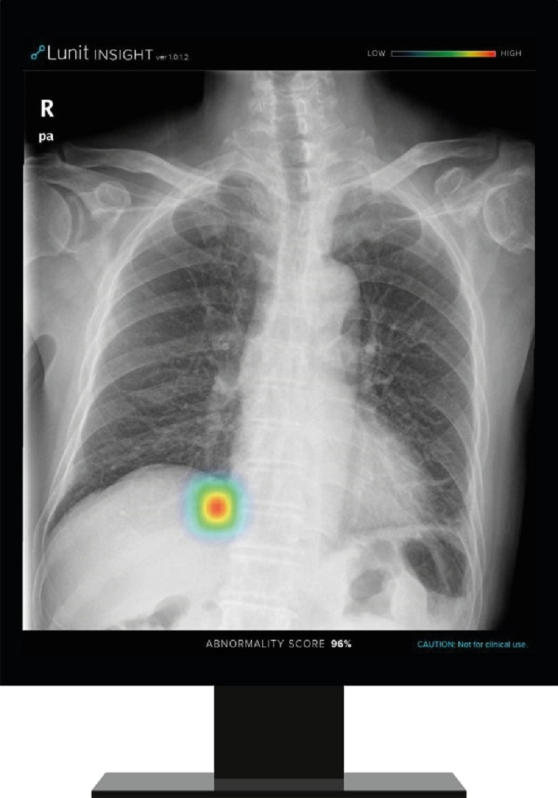 Partnership improves diagnostic X-ray services