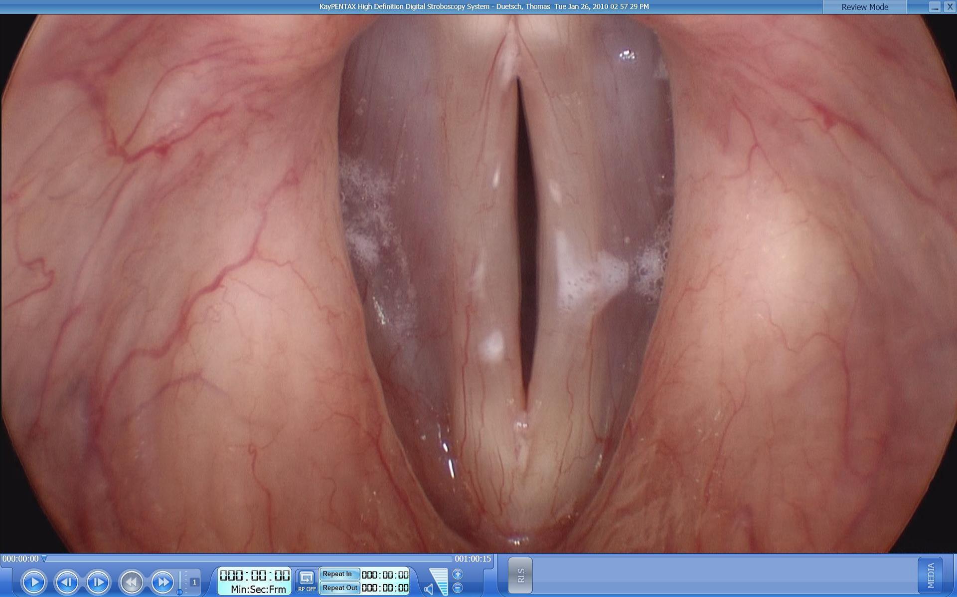 PENTAX Medical offers HD Stroboscopy system for ENT applications 