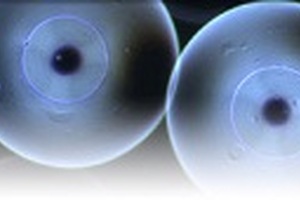 Philips and Biocompatibles oncology collaboration