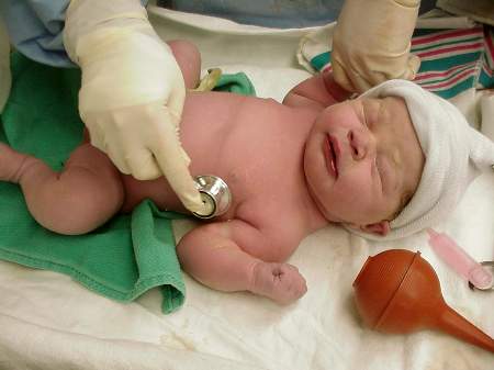 Pilot scheme to test new screening approach for newborns