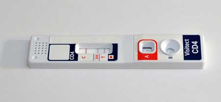 Point-of-care disposable HIV test launched