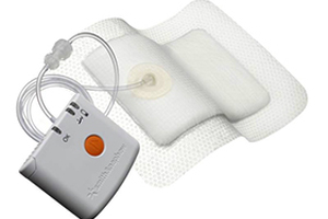 Private hospital in Liverpool uses new wound-healing technology