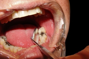 Probe into infection control at Scottish dental practices