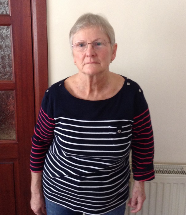 Prosthetic humerus enables woman to use her arm again