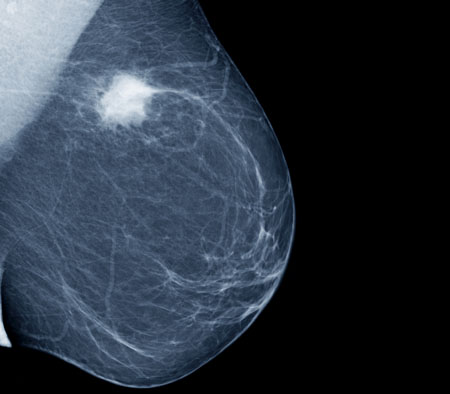 Proton therapy stakes claim as safest and most-effective cancer treatment