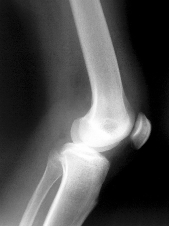 Rapid access, better care: Sharing imaging across the NHS