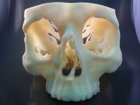 Reduced surgery times and lower costs follow implementation of 3D printing solutions at 12 NHS hospitals