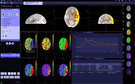Siemens announces updates to 3D and advanced reading software