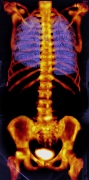 Siemens introduces the future of molecular imaging