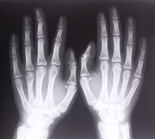 Six steps to improving medical image sharing