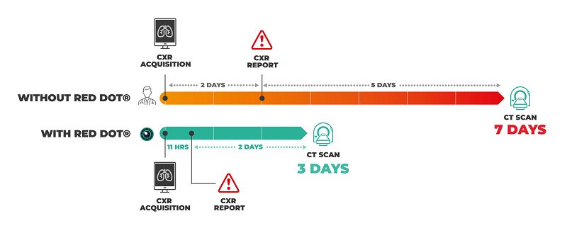 A study carried out by Somerset NHS Foundation Trust showed the time taken from chest X-ray to CT scan was reduced from seven to 2.8 days as a result of using the AI algorithm