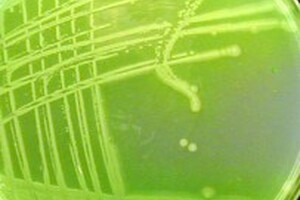 Stark warning for water tank manufacturers following Pseudomonas discovery