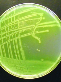 Stark warning for water tank manufacturers following Pseudomonas discovery