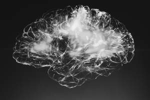 Stroke care: Meeting new SSNAP changes