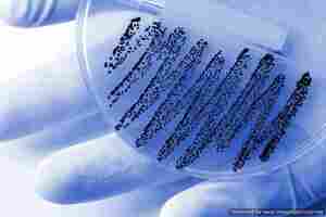 Survey highlights missed opportunities to reduce hospital acquired infections