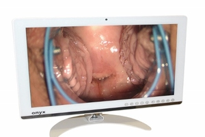 Technology boost for cervical screening in Wales 